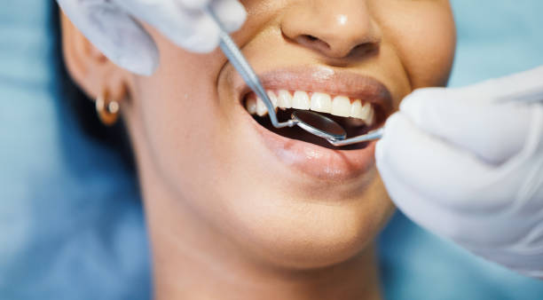 Best Emergency Dental Surgery in Bluffdale, UT